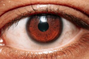 Top Benefits of HydroEye® Softgels Vitamins for Dry Eye Disease
