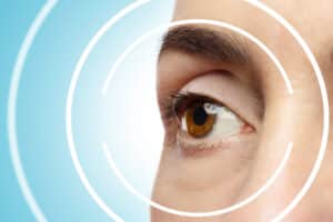 Close-up of a woman's brown eye. She is ready to undergo laser vision correction for better sight without glasses